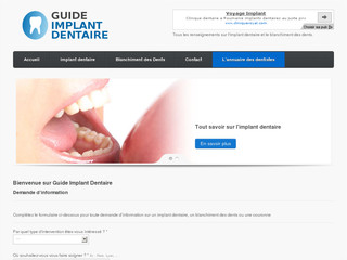 http://www.guide-implant-dentaire.com/